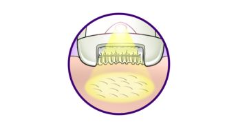 Opti-light     