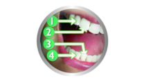 Encourages recommended whole mouth cleaning for 2 minutes