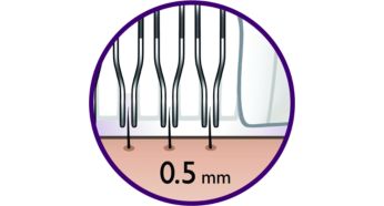 This epilation system removes hair as short as 0.5 mm