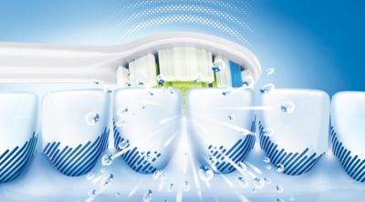 最大 5 倍の歯垢を除去