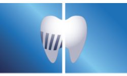 Эффективное удаление налета