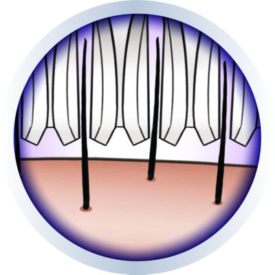 Hypo-allergenic ceramic discs