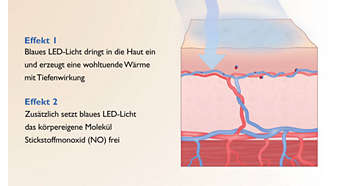 Soothing effect: warmth and the body’s own processes