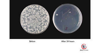 Антибактериальный корпус предотвращает размножение бактерий
