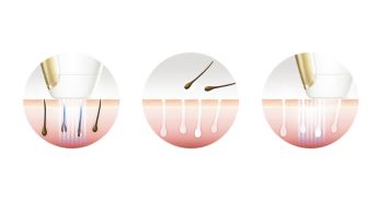 Enjoy smooth skin every day