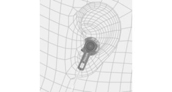 Anillo de estabilidad para una fijación segura en la oreja