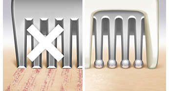 Pearl-tip trimmer and safety bars protect from scratches
