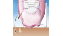 Уникальная эпиляционная система Philips