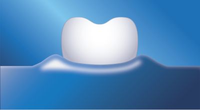 Improves gum health