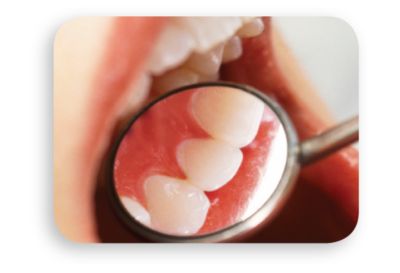 Improves gum health