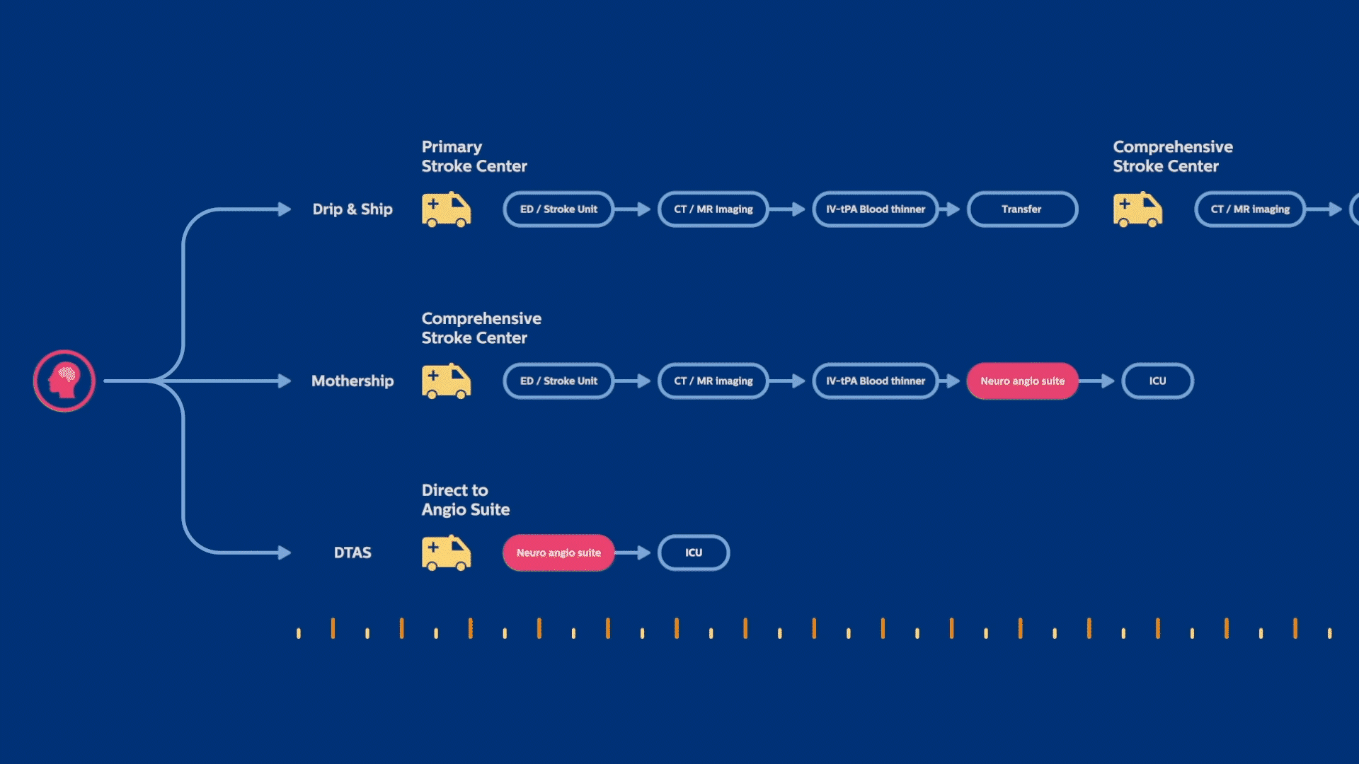 We zijn voorloper op het gebied van Direct-to-Angio Suite (DTAS)-workflows om de tijd tot behandeling drastisch te verkorten en de resultaten te verbeteren