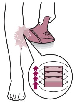 Schéma correct de flashs avec Philips Lumea