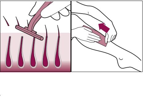 필립스 루메아를 사용하기 전에 피부에서 체모 제거