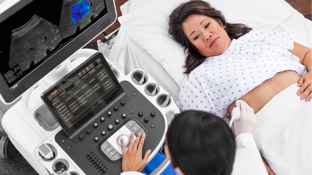 doctor checking the scan