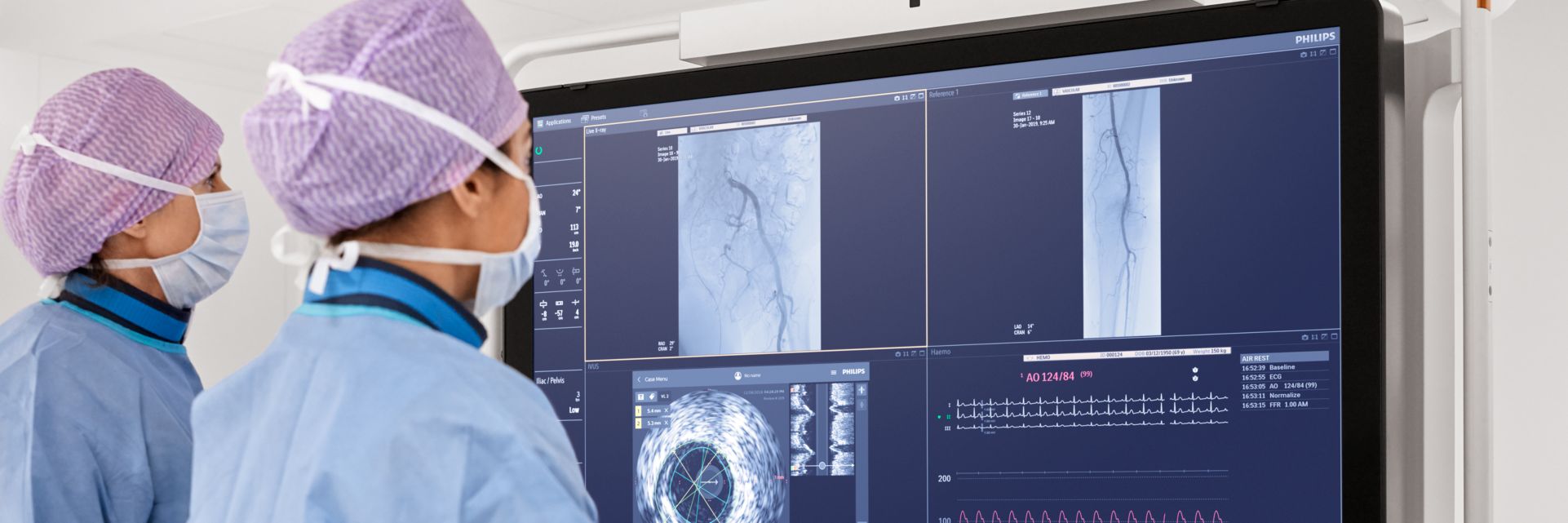 Clinicians use an artherectomy device in an interventional suite.