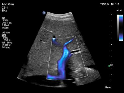 MicroFlow Imaging – Products & Services – Philips