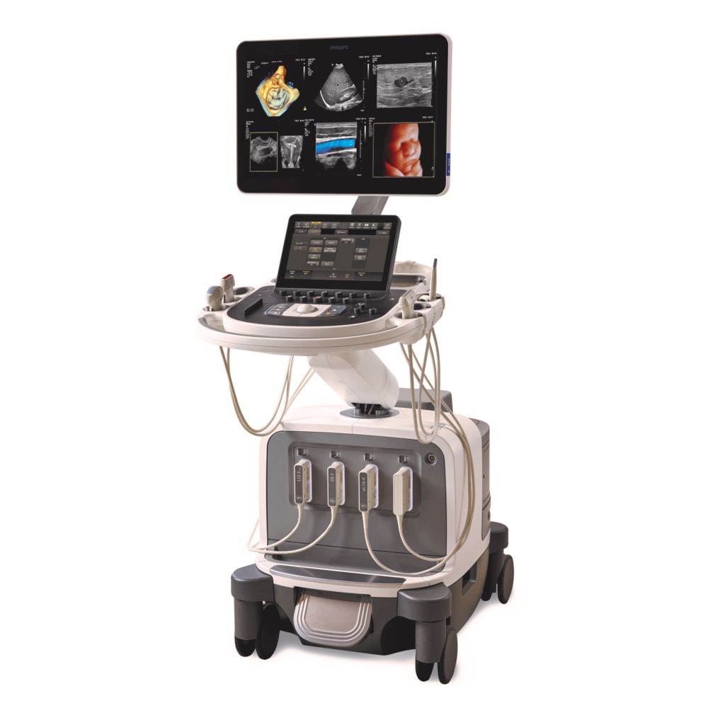 El transductor X6-1 xMATRIX es compatible con el Model AAA