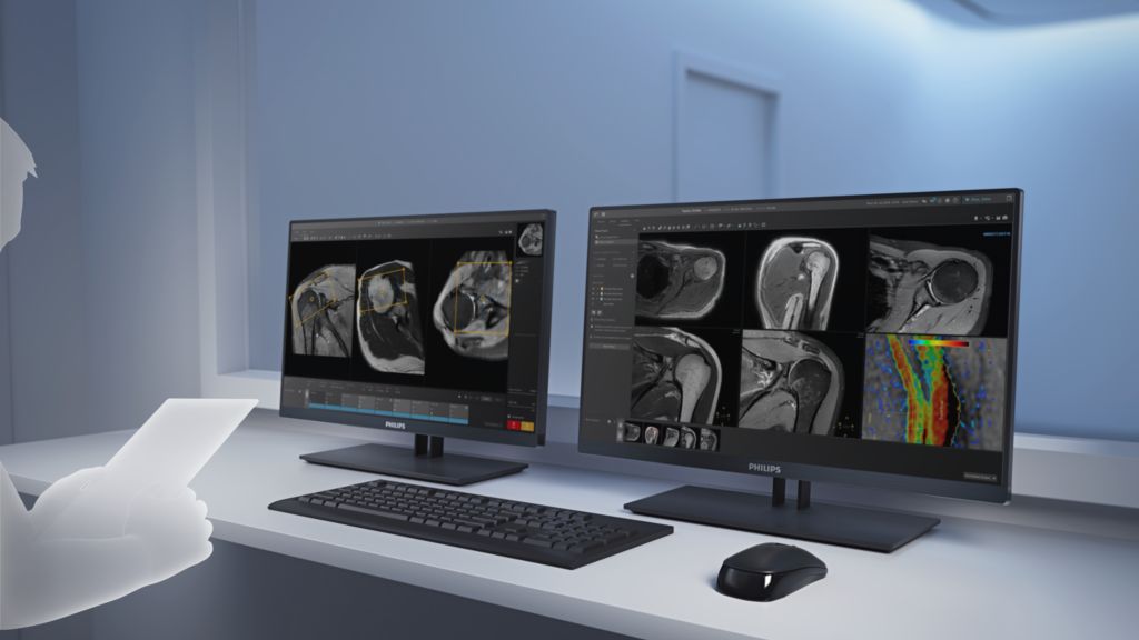 Enter patient information in advance to plan a full day ahead of time