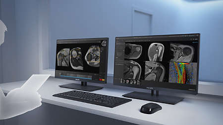 Enter patient information in advance to plan a full day ahead of time