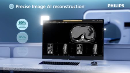 85 cm bore--largest in its class for patient access, comfort video