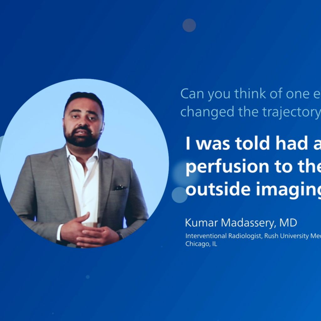 Kumar Madassery, MD Peripheral IVUS testimonial