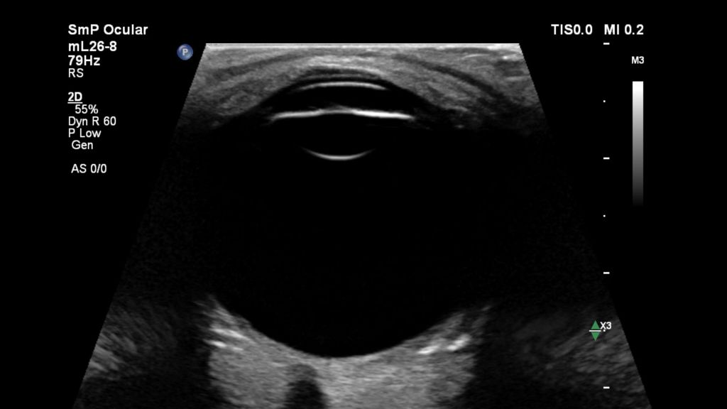 Ocular with Flow Viewer