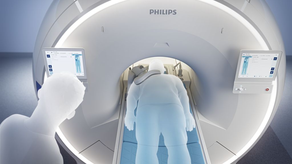 Patient automatically to iso-center
