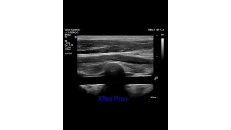 xRes Pro+ video