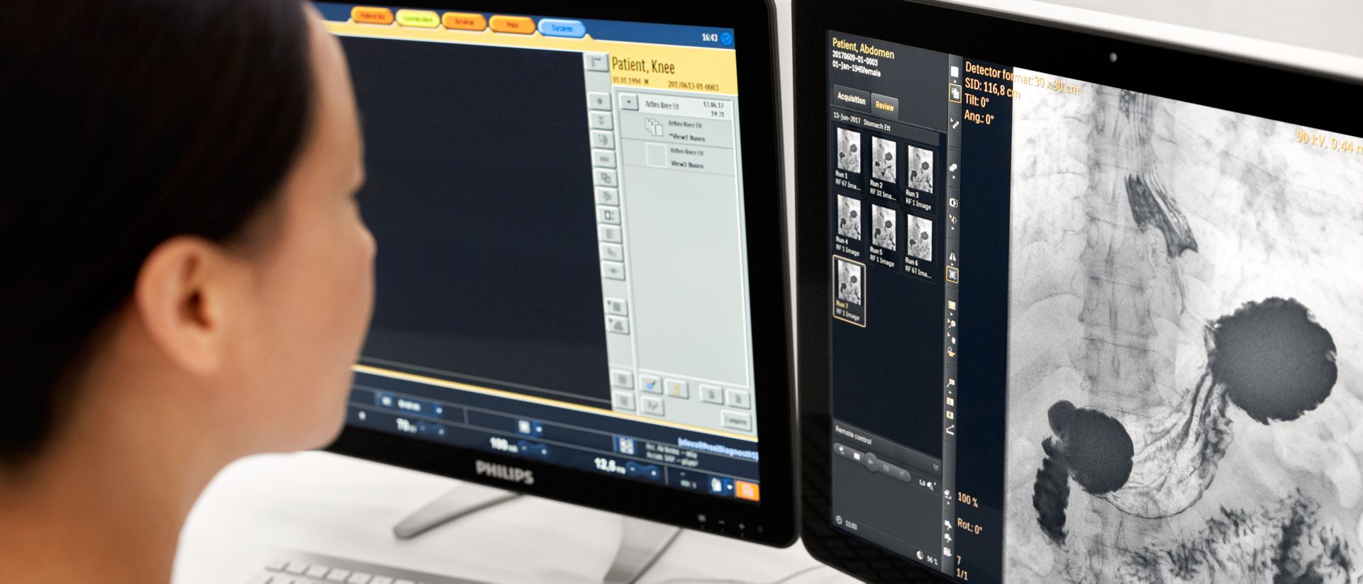 Keep your equipment up to date with SmartPath Philips