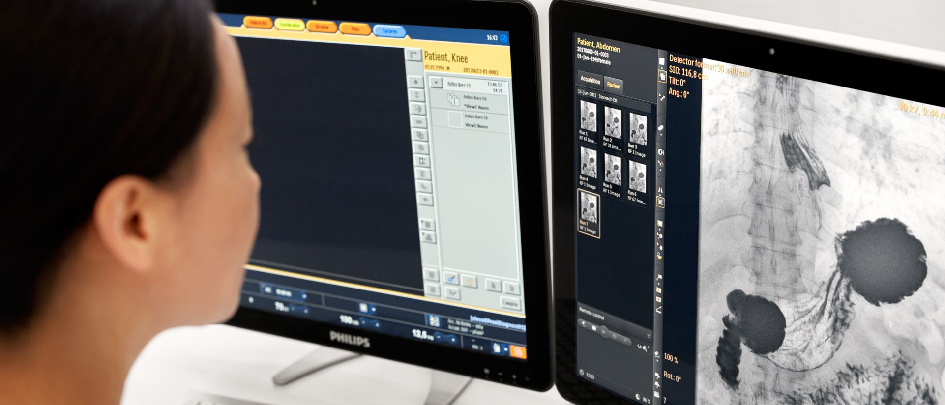 Keep your equipment up to date with SmartPath Philips