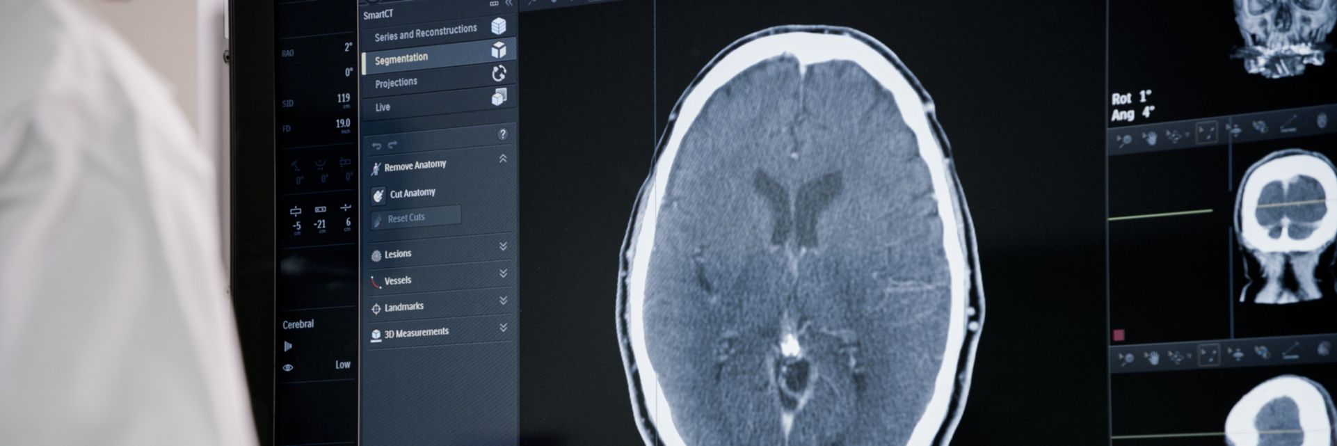 Image SmartCT Soft Tissue Neuro