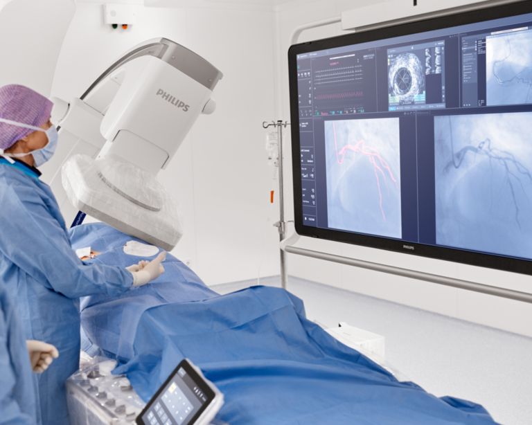 Two clinicians viewing screens using ClarityIQ during interventional procedure.