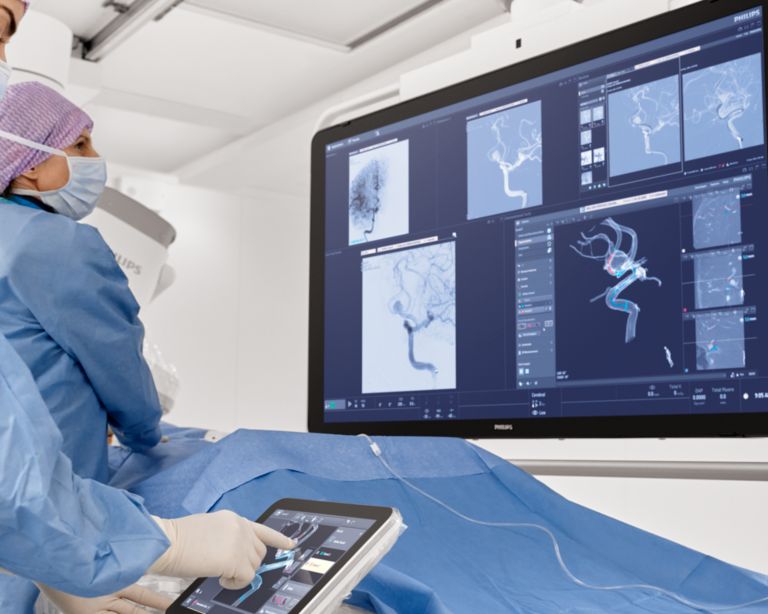 Cerebral aneurysm treatment