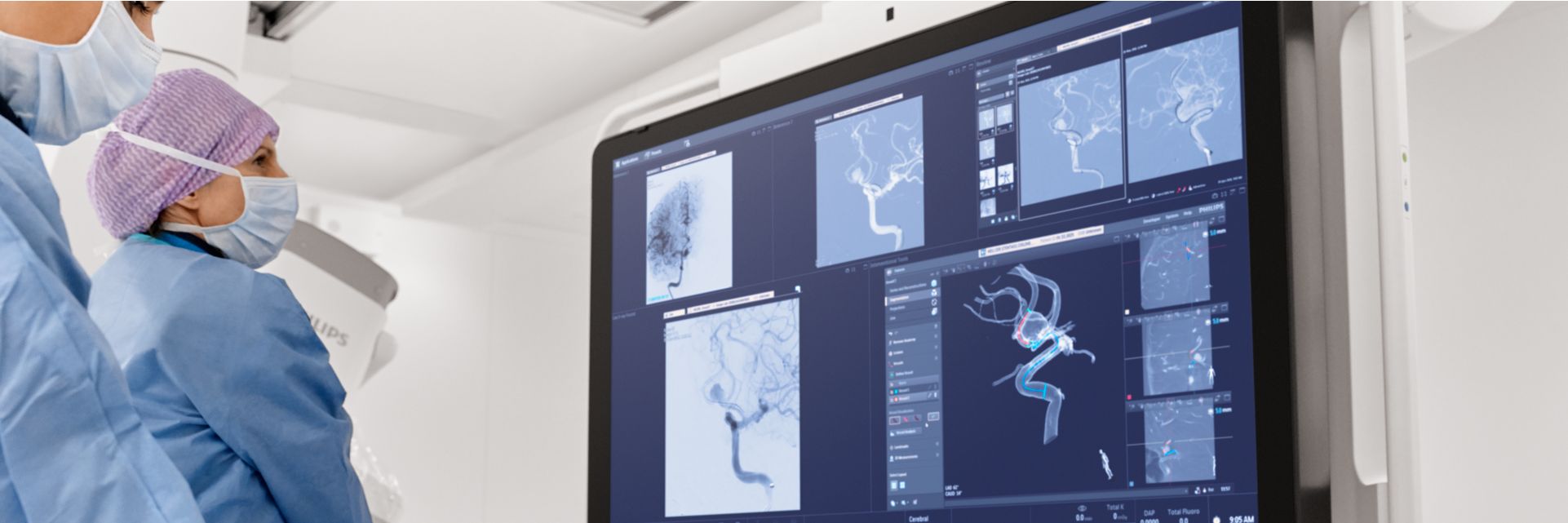 Treating cerebral aneurysms
