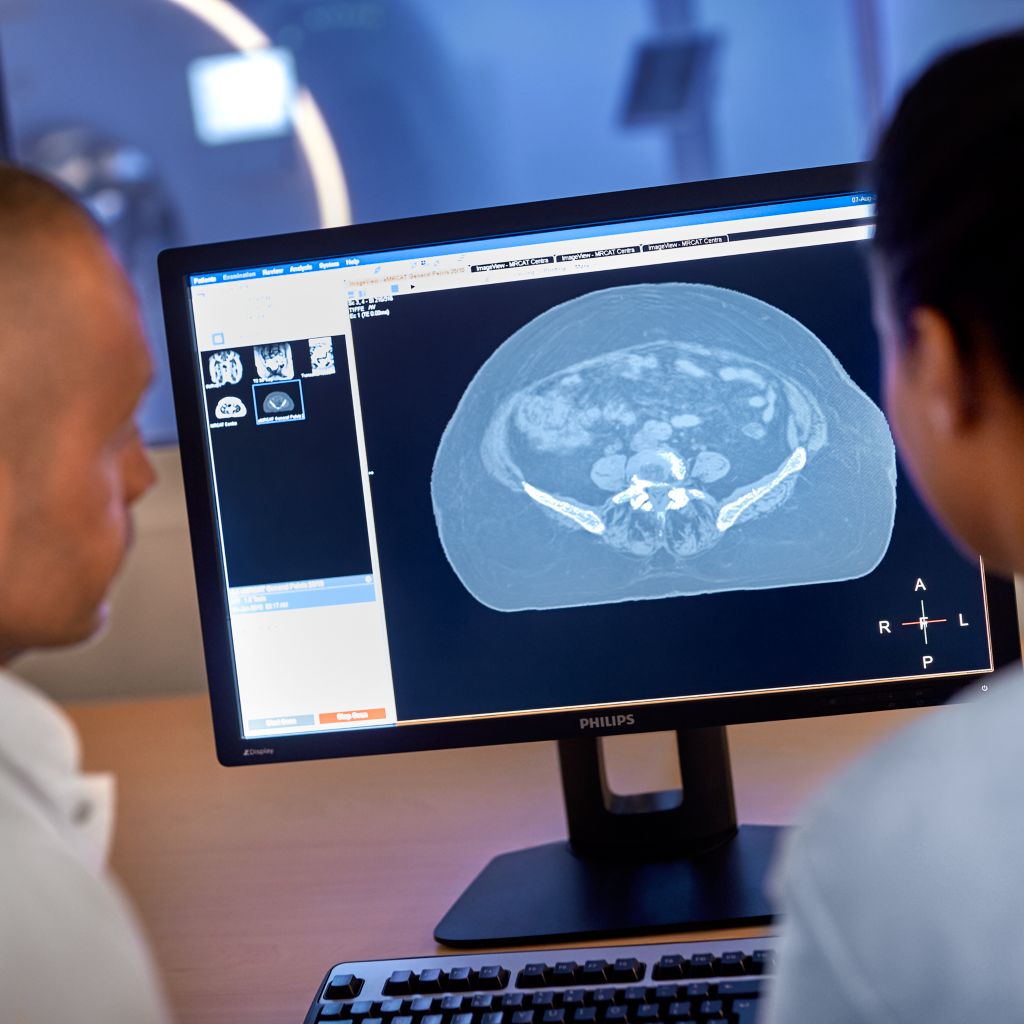 MR-only radiotherapy planning