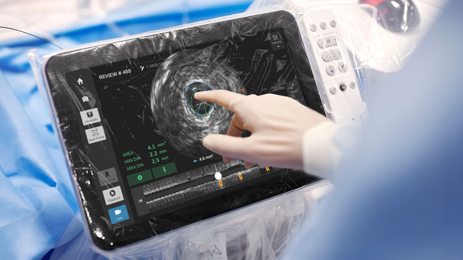 Close-up image of gloved hand pointing at IntraSight Plus tableside monitor
