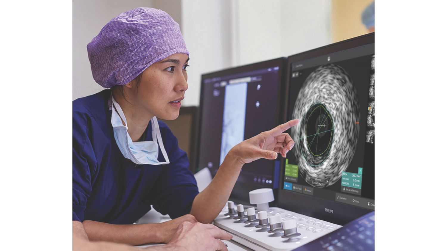 Coronary IVUS study