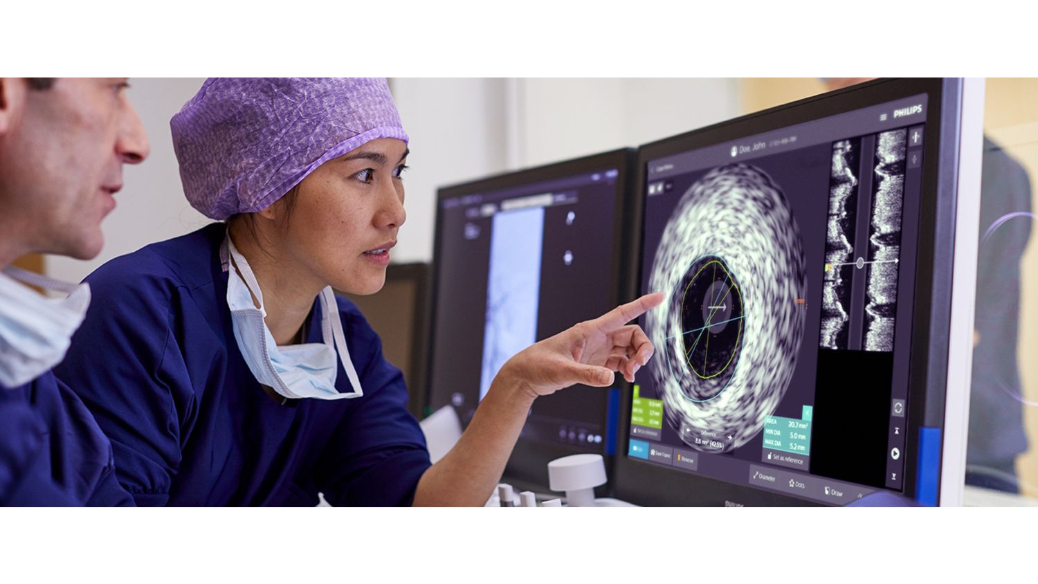 Coronary IVUS study