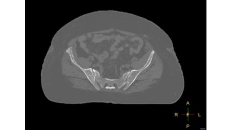 Automatic generation of synthetic CT images video