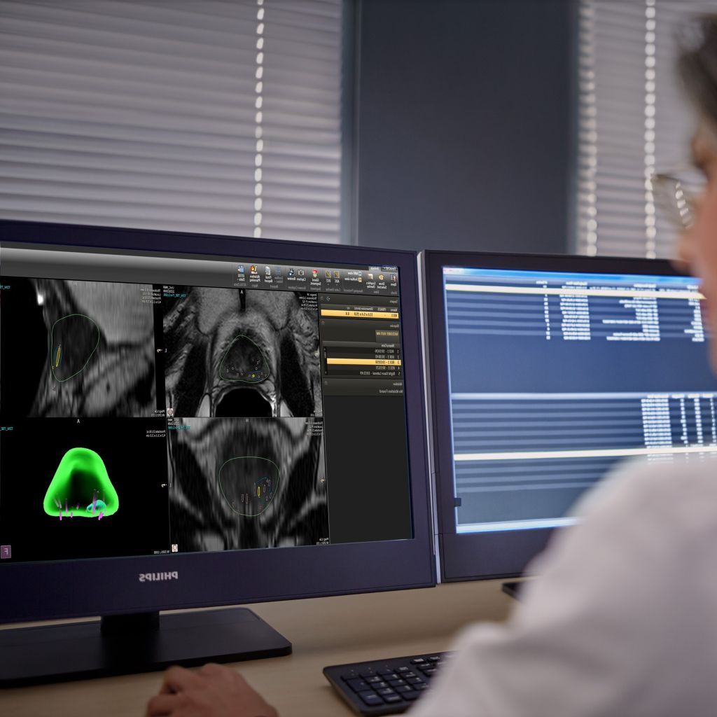 DynaCAD prostate