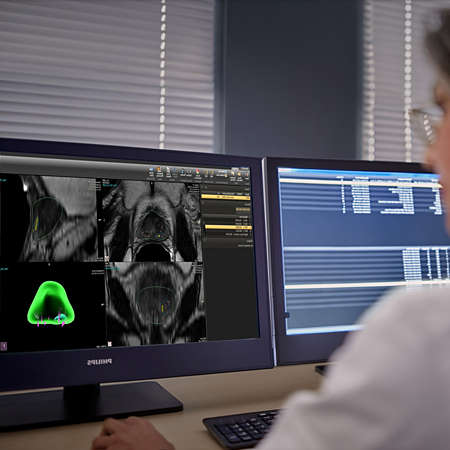 DynaCAD prostate