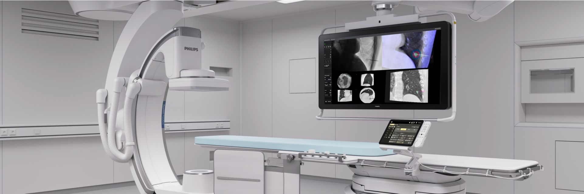 XperGuide kidney cryo ablation