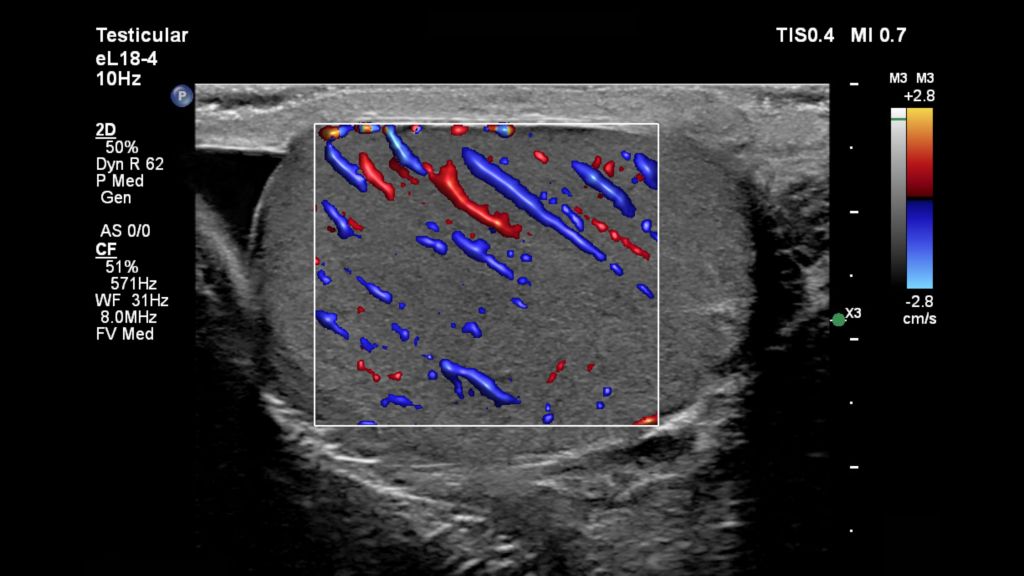 Testicle with Flow Viewer