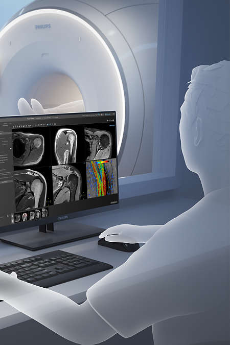 Discover Philips MR Smart Workflow