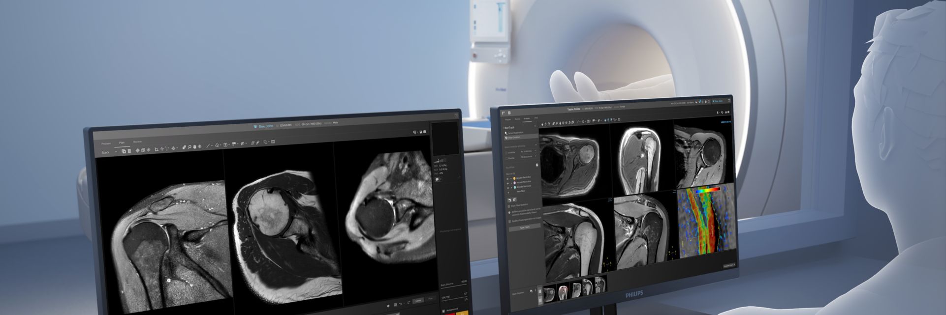 Discover Philips MR Smart Workflow