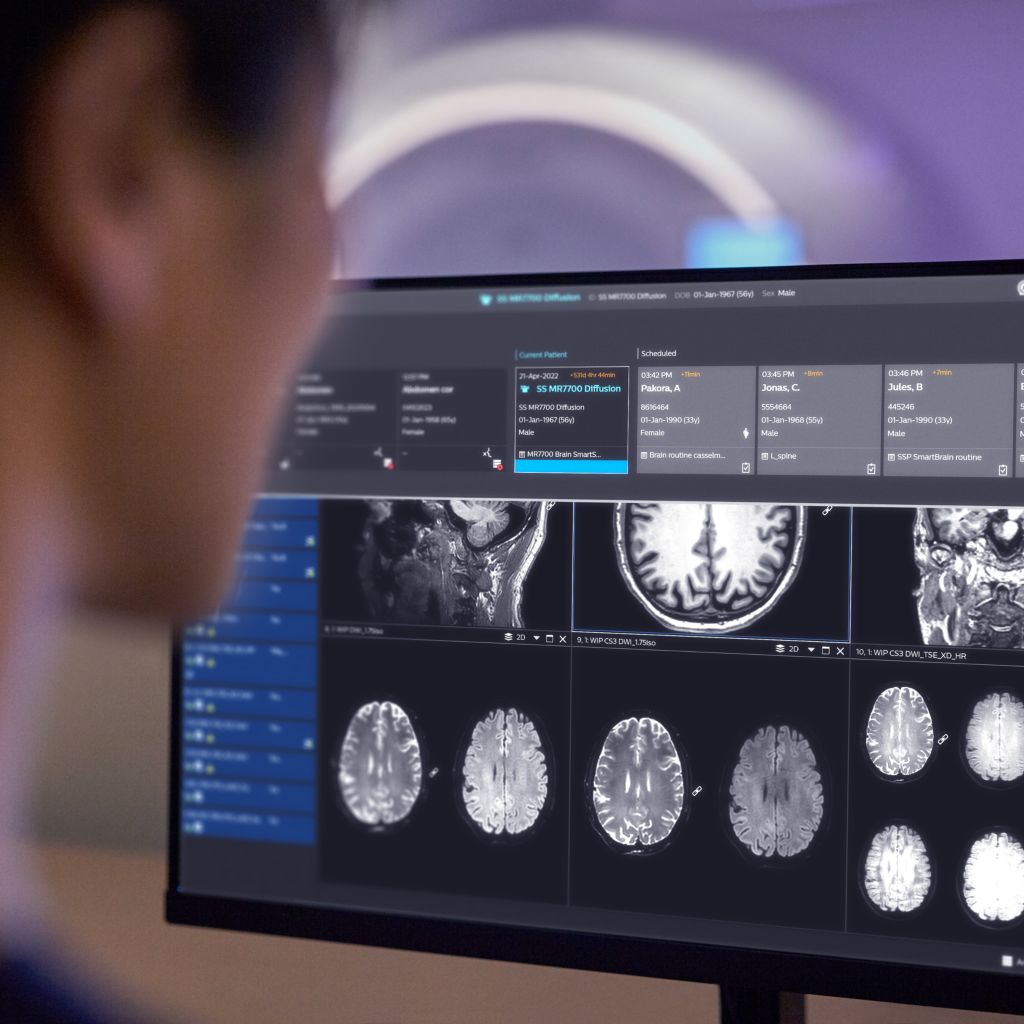 Technologist sitting behind the MR console reviewing the daily schedule for scanning patients