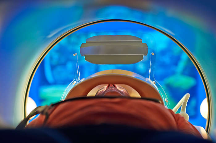 Philips, scans, image-guided therapy