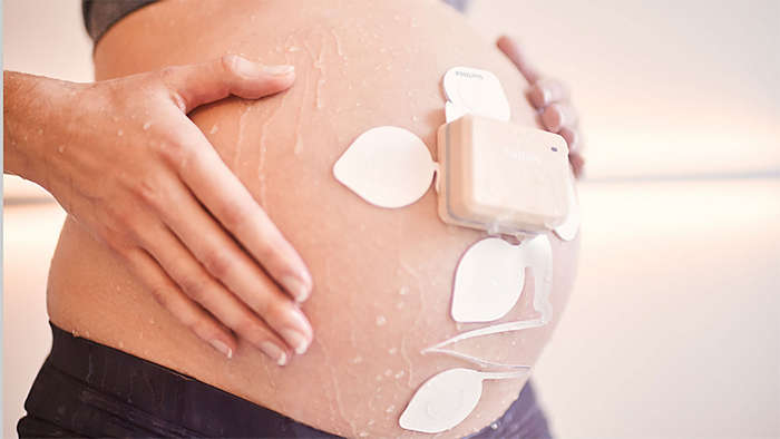 Avalon CL Fetal and Maternal Pod & Patch Close Up