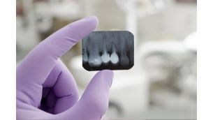 Problem med tandköttet | Philips