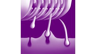 Sistema de depila&ccedil;&atilde;o eficiente que remove os pelos pela raiz